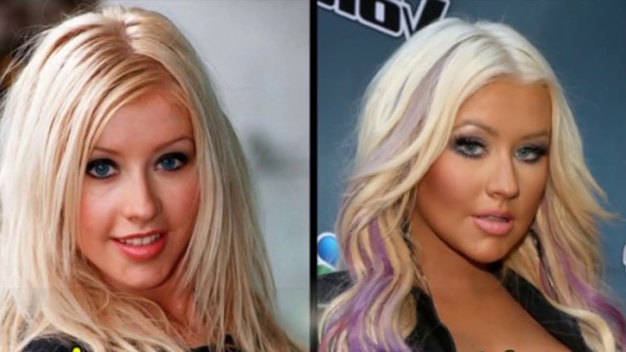 celebs before and after