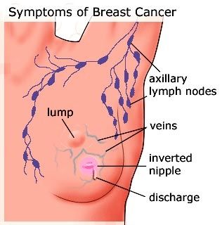 cancer effects after side breast