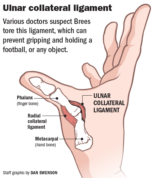 thumb ligament surgery