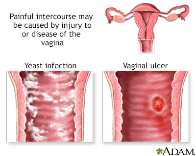 vaginal causes of soreness