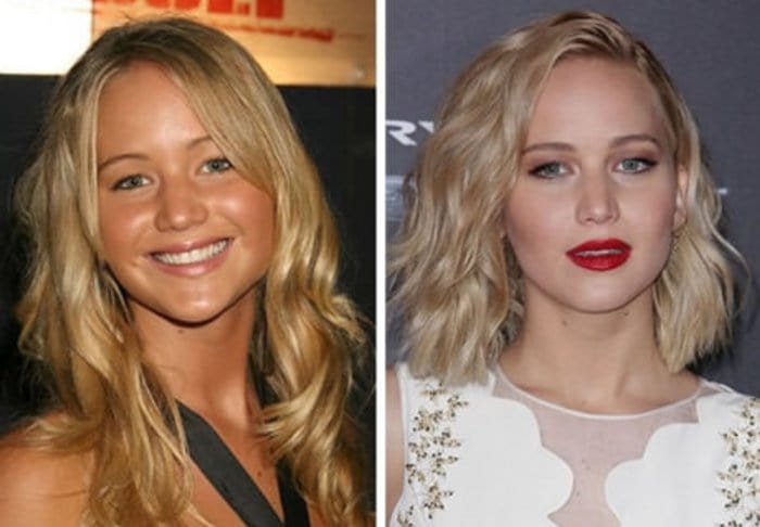 celebs after before and