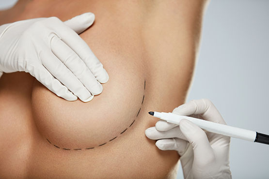 surgery before herb breast