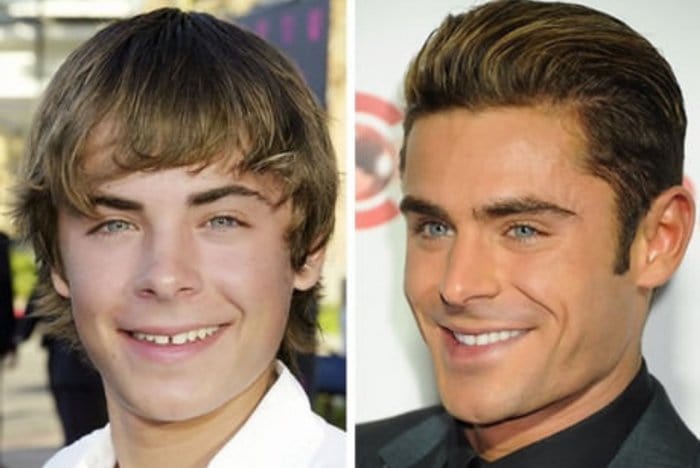 celebs before and after